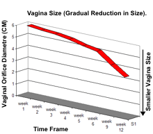 VAGINA SIZE vagina size: